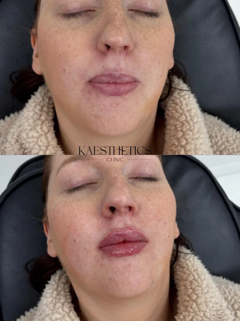 Kaesthetics Clinic portfolio